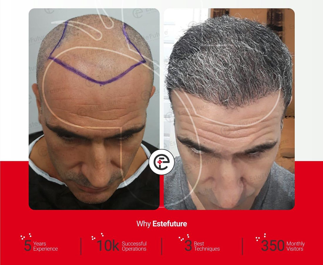 Este Future - Este Future