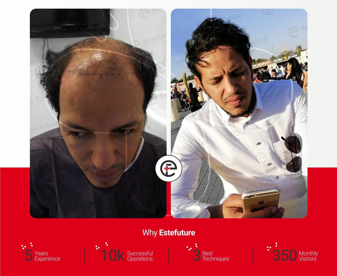 Este Future - Este Future