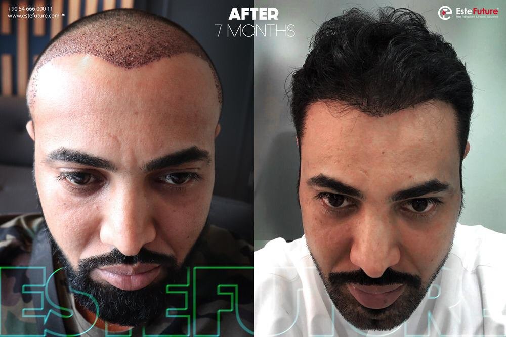 Este Future - Este Future