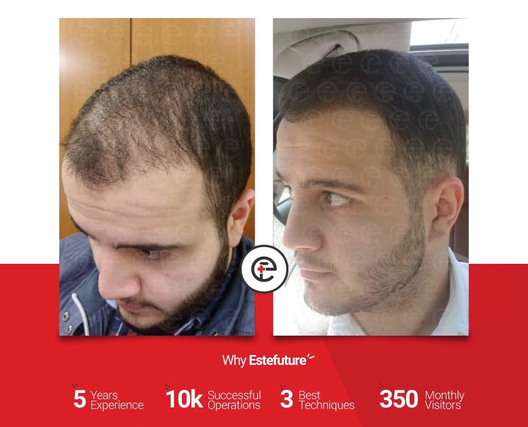 Este Future - Este Future