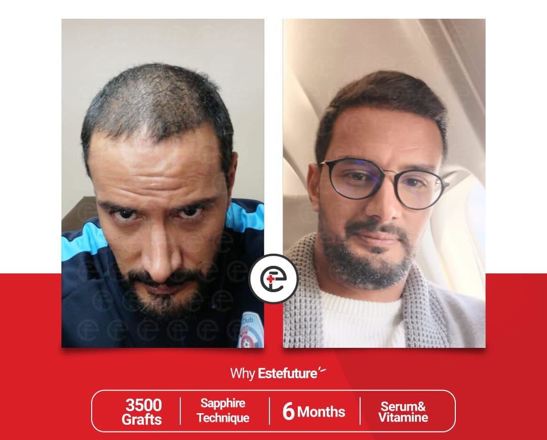 Este Future - Este Future