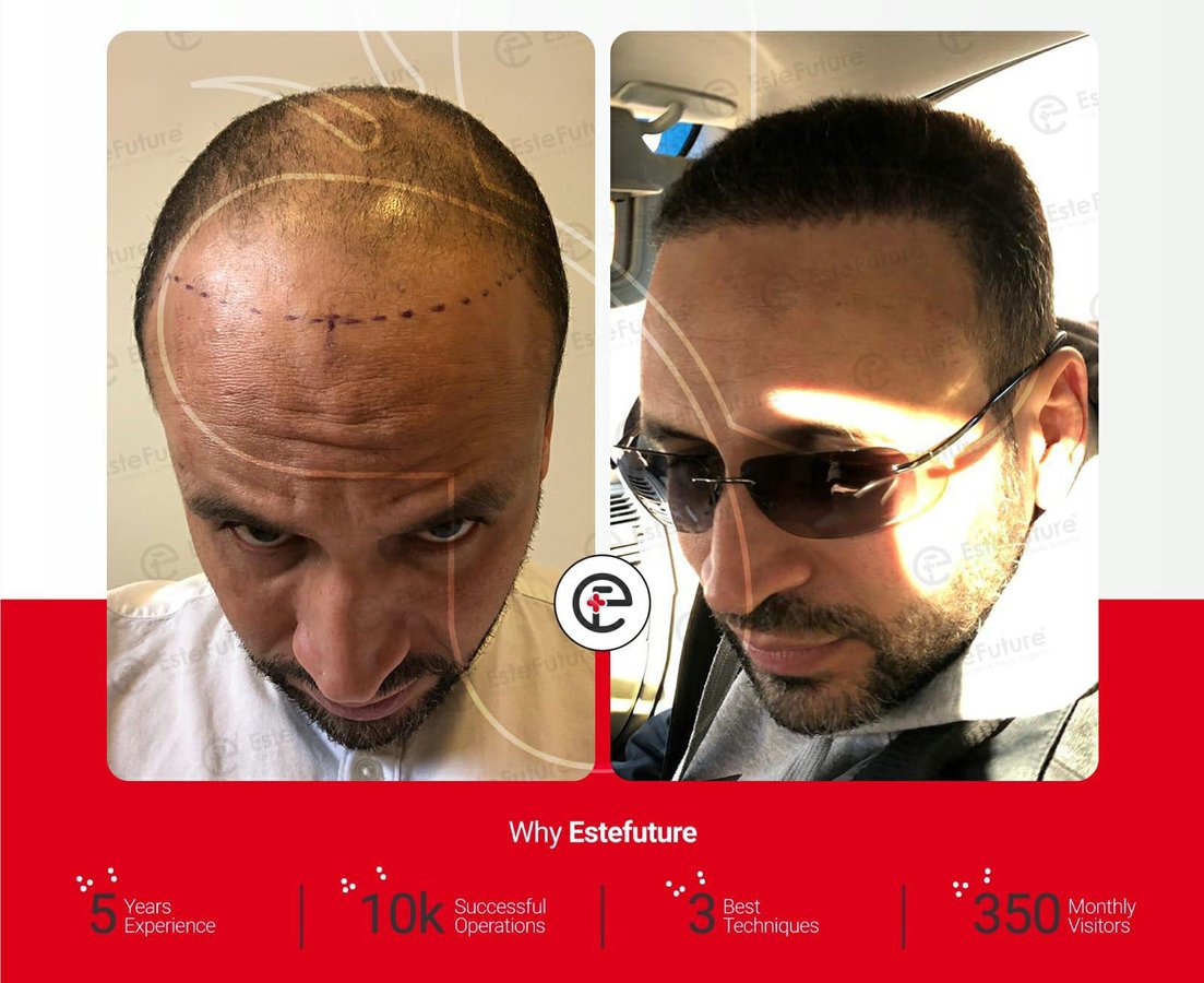 Este Future - Este Future