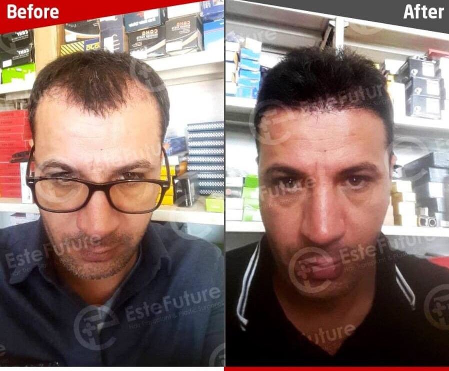 Este Future - Este Future