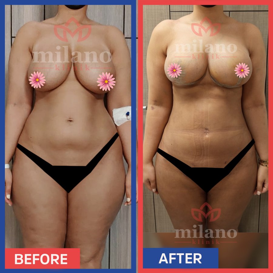 Este Milano - Este Milano