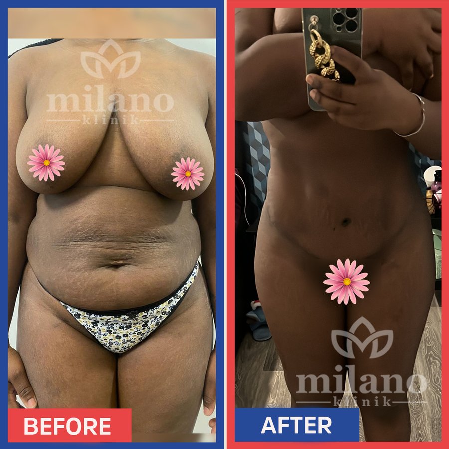 Este Milano - Este Milano