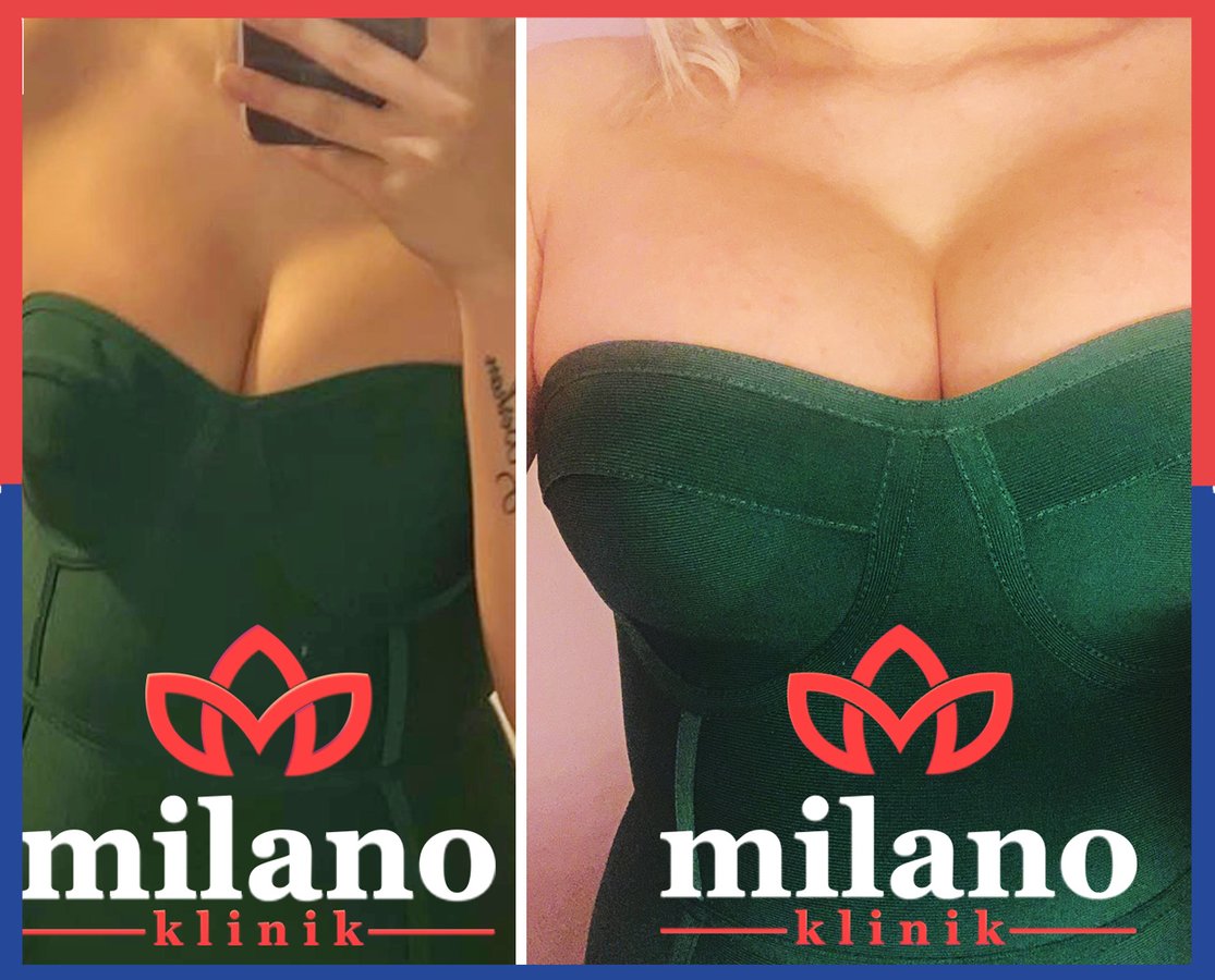 Este Milano - Este Milano