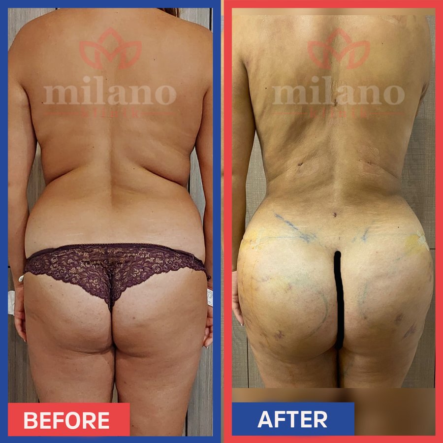 Este Milano - Este Milano