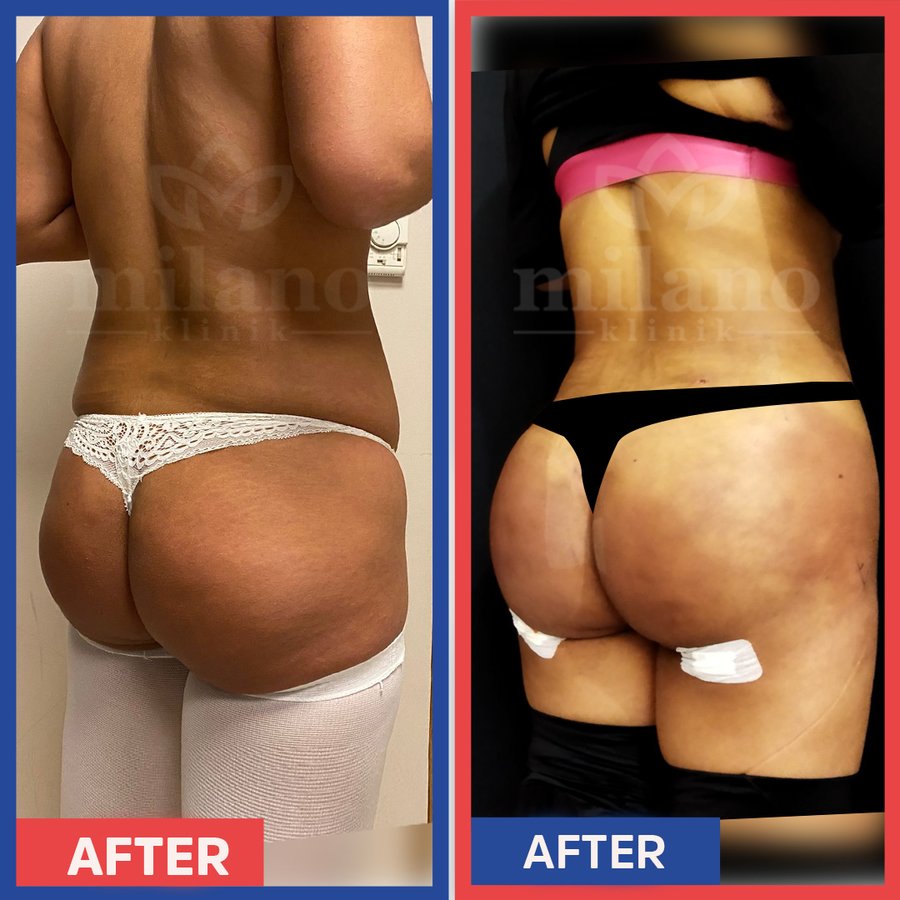 Este Milano - Este Milano