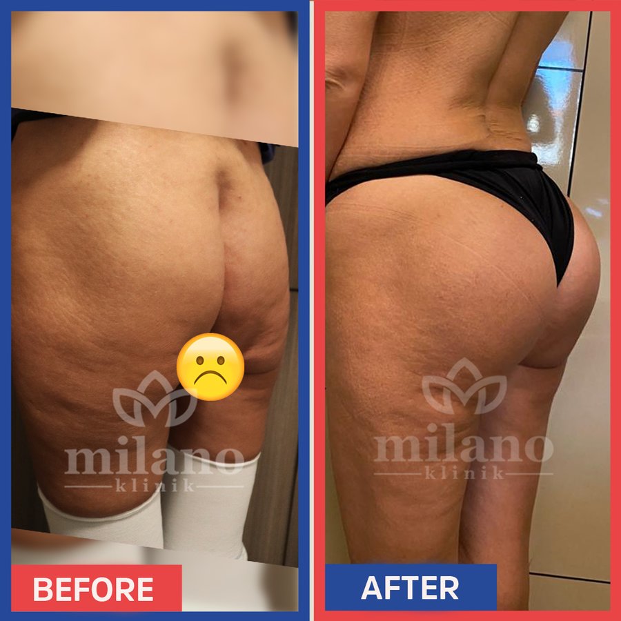 Este Milano - Este Milano