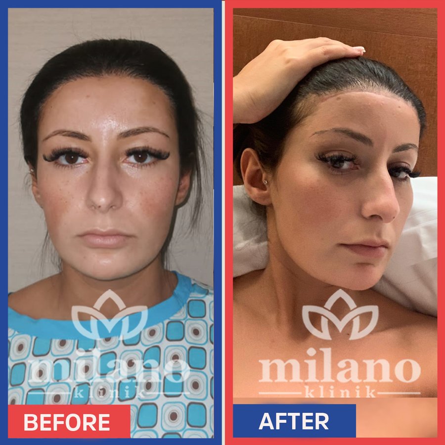 Este Milano - Este Milano