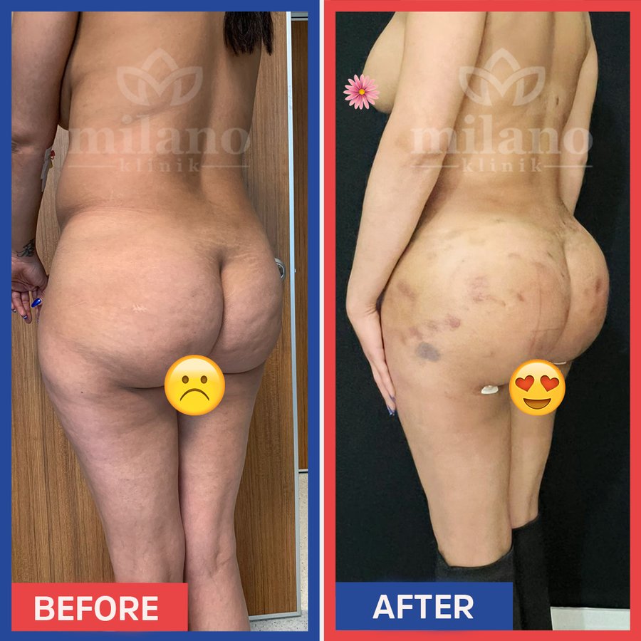 Este Milano - Este Milano