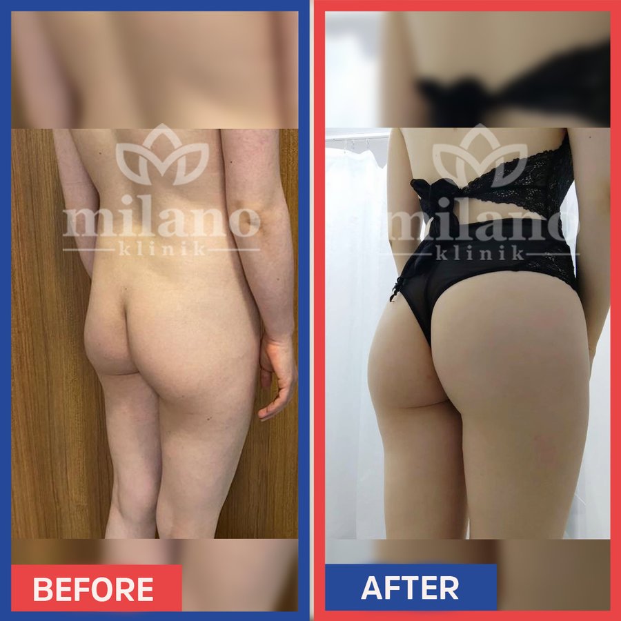 Este Milano - Este Milano