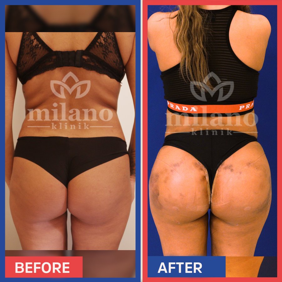 Este Milano - Este Milano