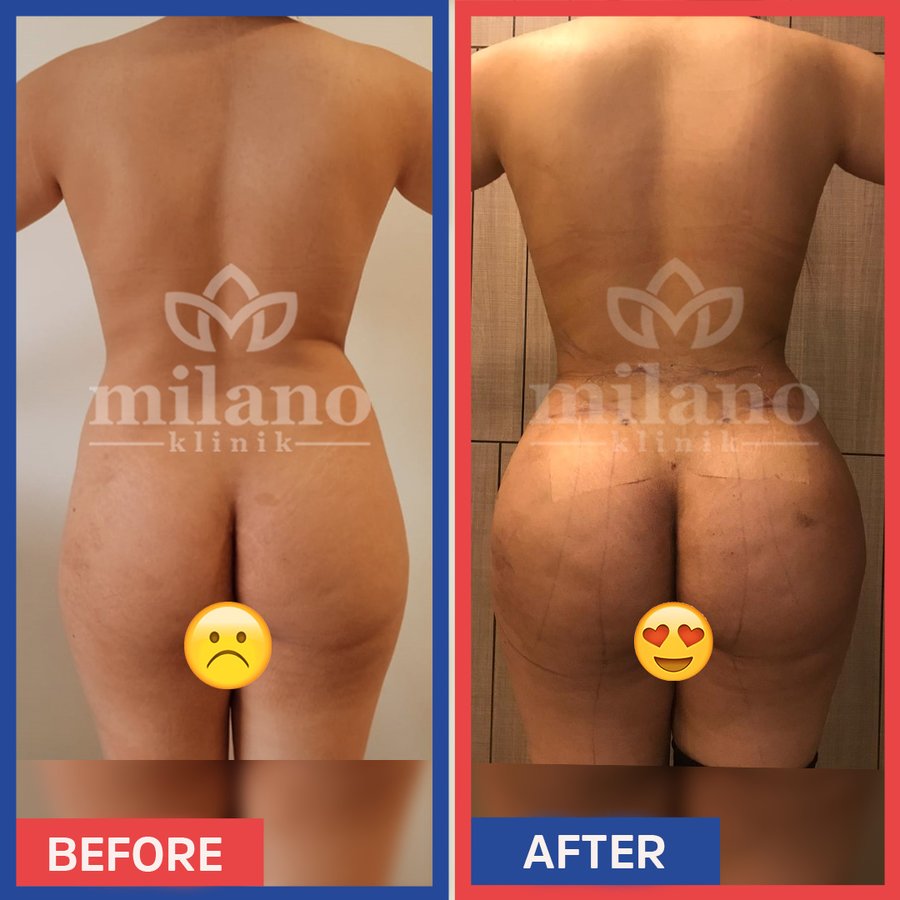 Este Milano - Este Milano