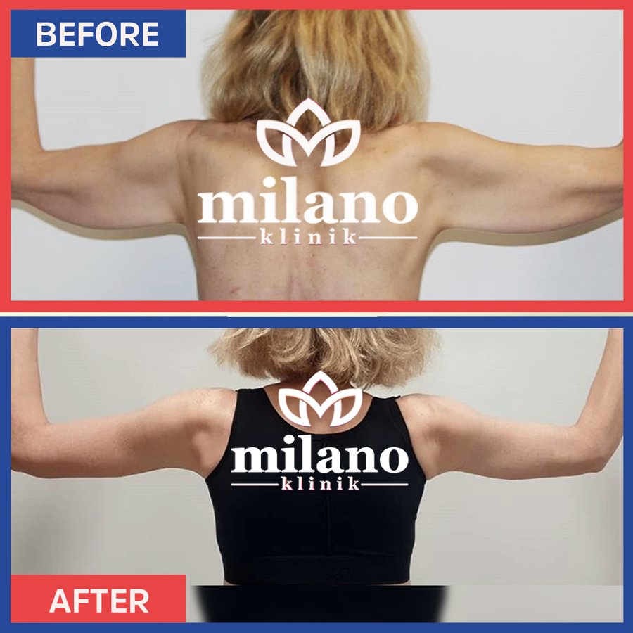 Este Milano - Este Milano