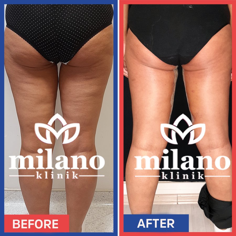 Este Milano - Este Milano