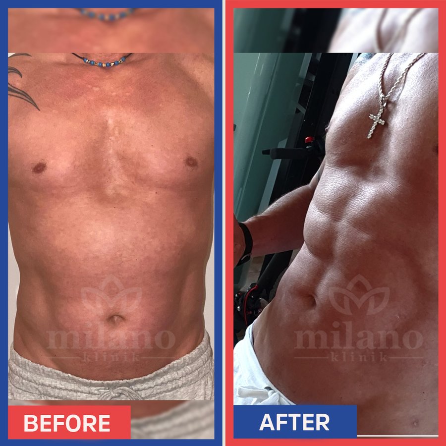 Este Milano - Este Milano