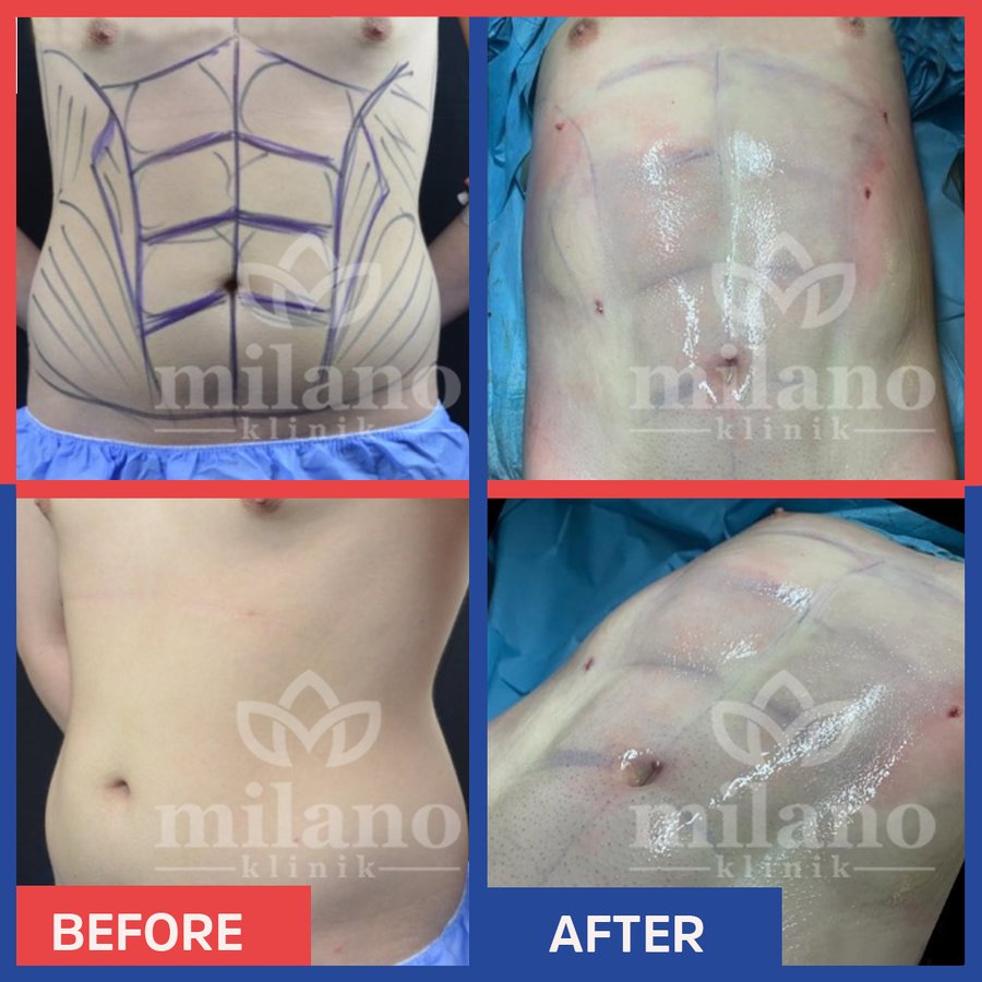 Este Milano - Este Milano