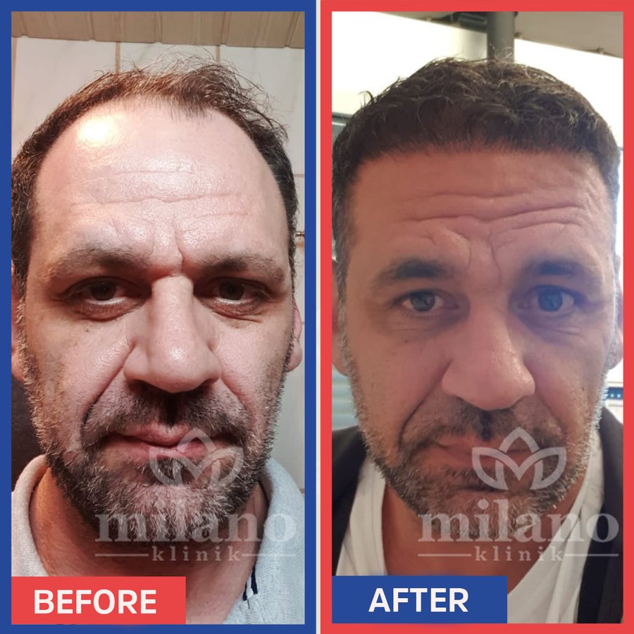 Este Milano - Este Milano