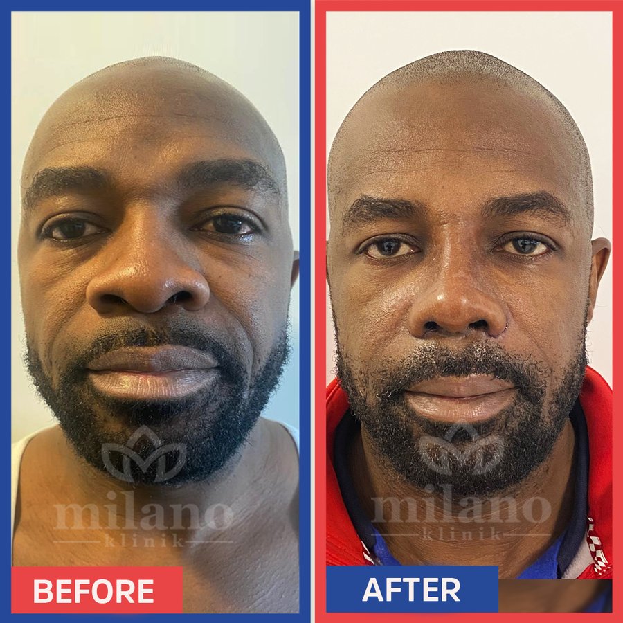 Este Milano - Este Milano