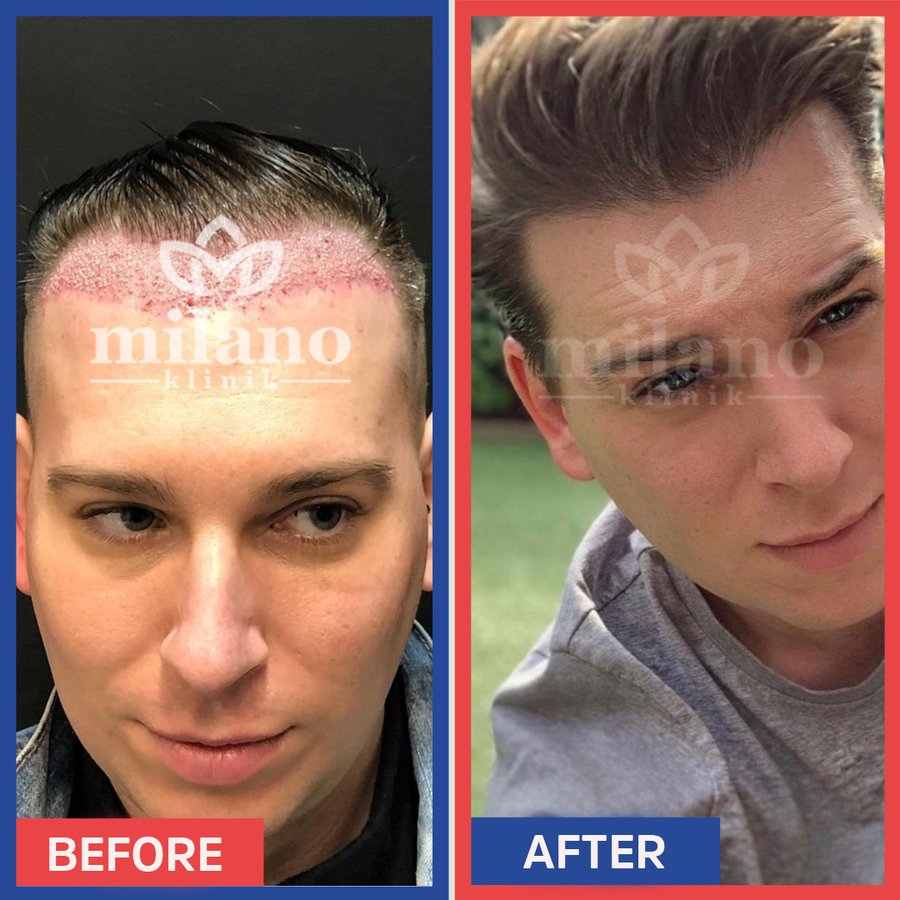 Este Milano - Este Milano