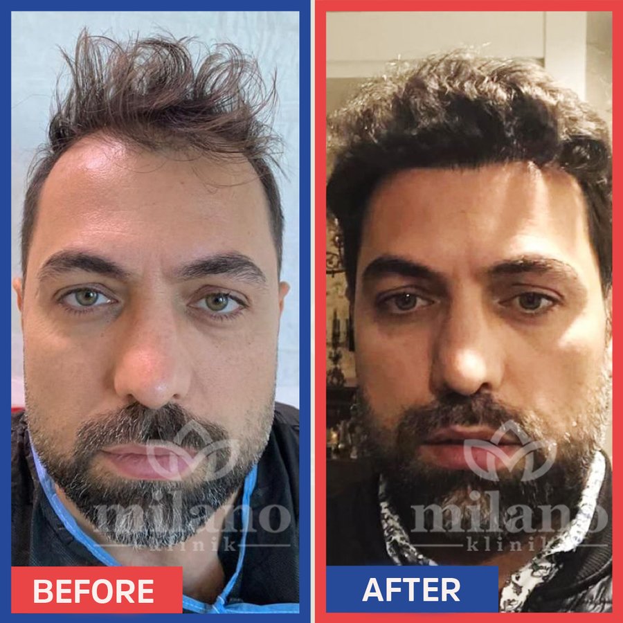 Este Milano - Este Milano