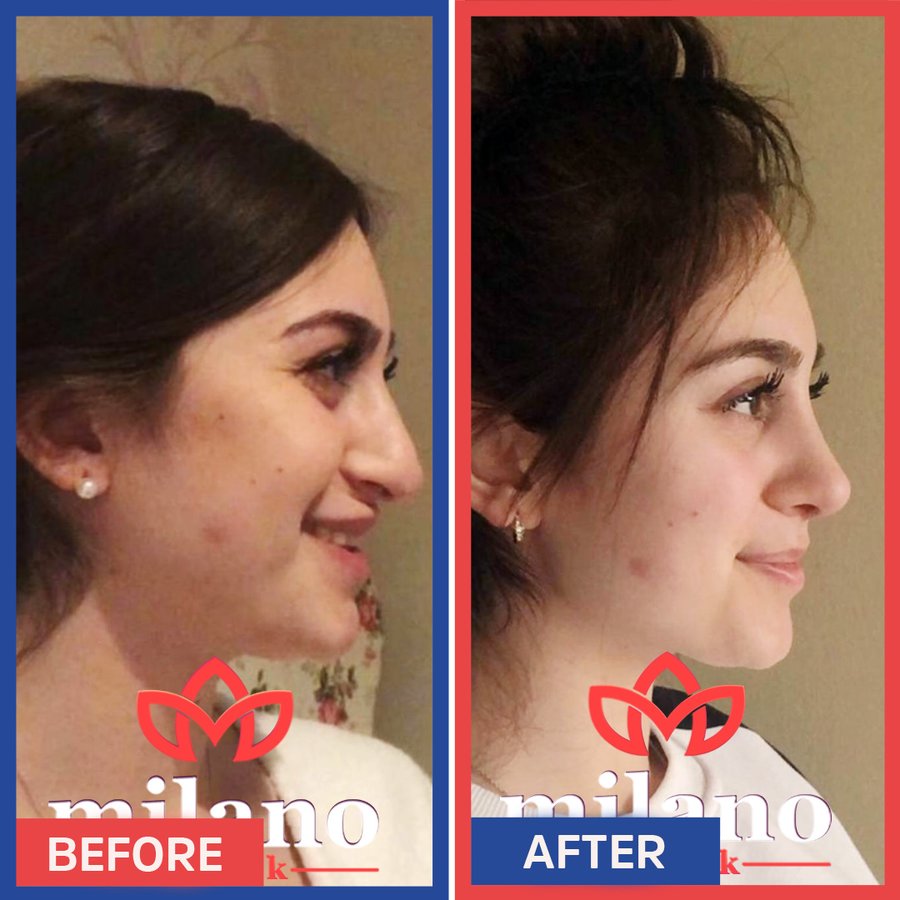 Este Milano - Este Milano