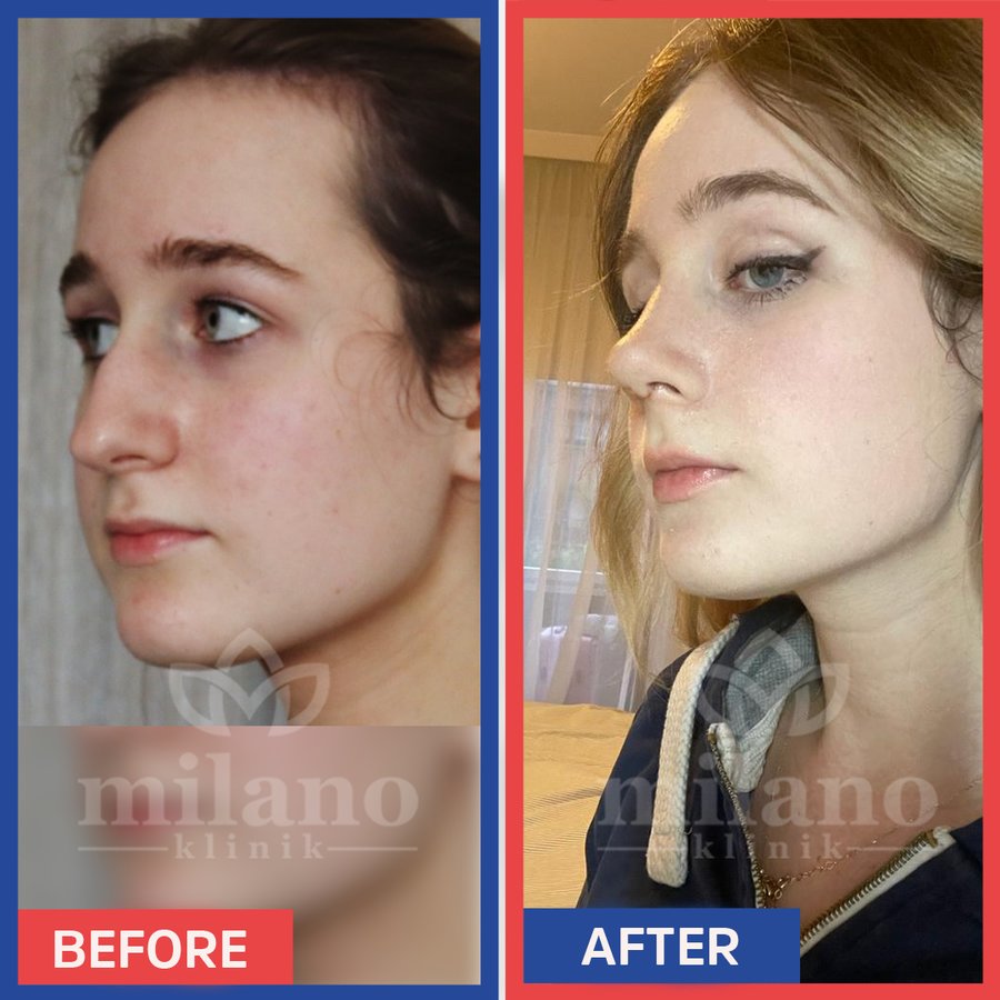 Este Milano - Este Milano