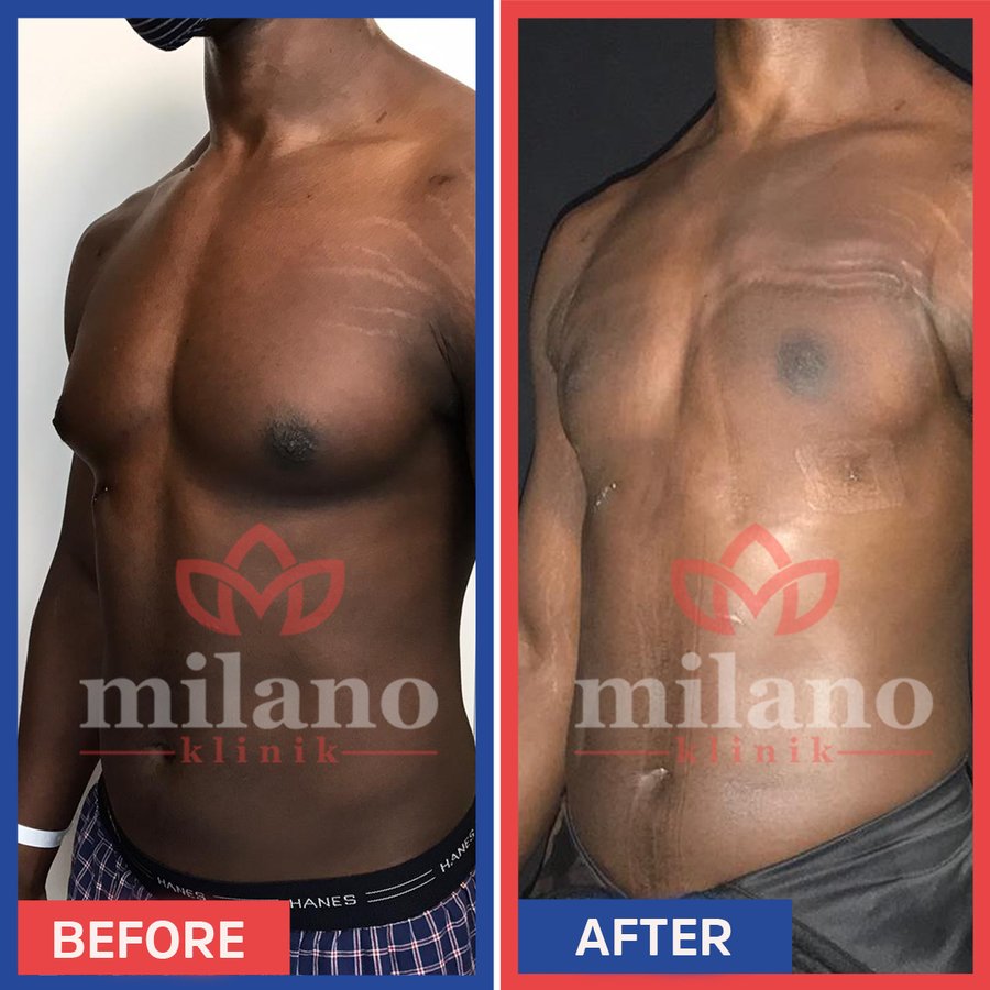 Este Milano - Este Milano