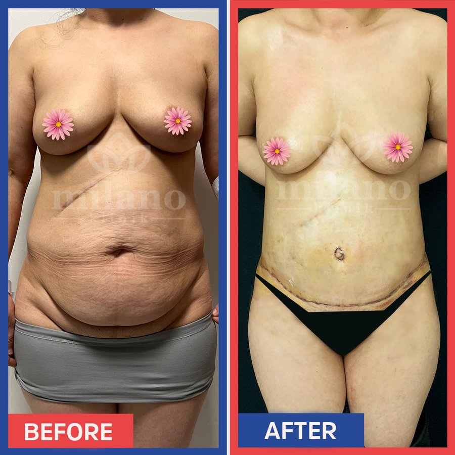 Este Milano - Este Milano