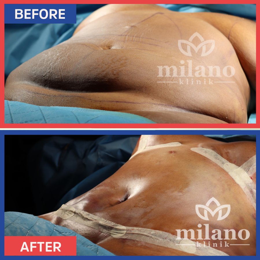 Este Milano - Este Milano