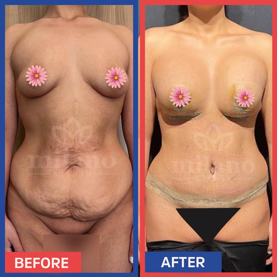 Este Milano - Este Milano