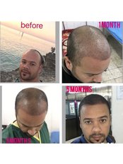 Este Palace in Turkey - Este Palace in Turkey