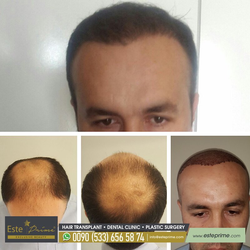 Este Prime - Este Prime