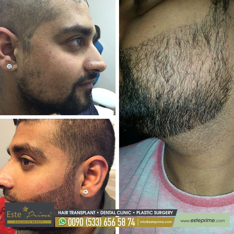 Este Prime - Este Prime