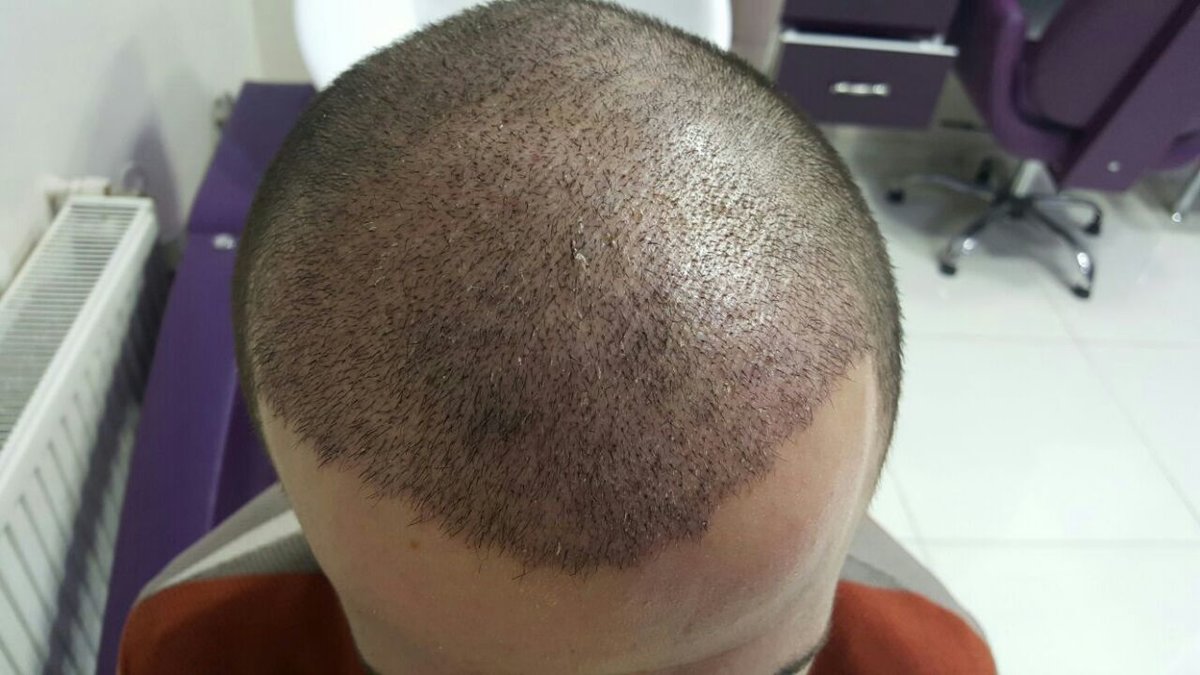 Este Prime - Este Prime