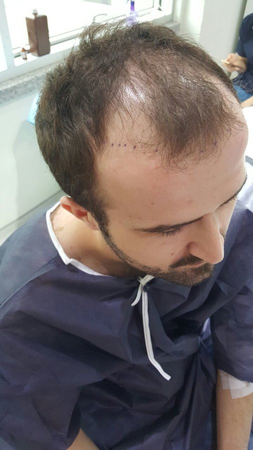 Este Prime - Este Prime