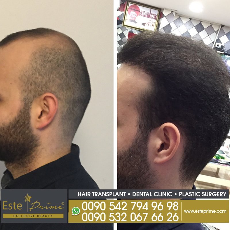 Este Prime - Este Prime