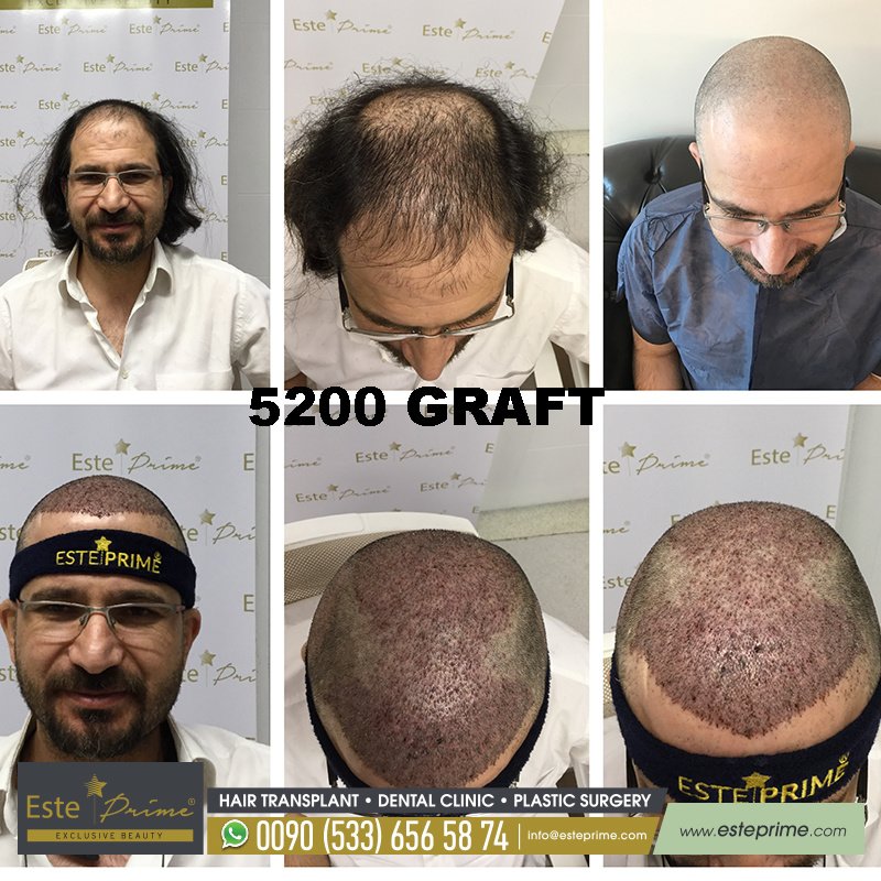 Este Prime - Este Prime