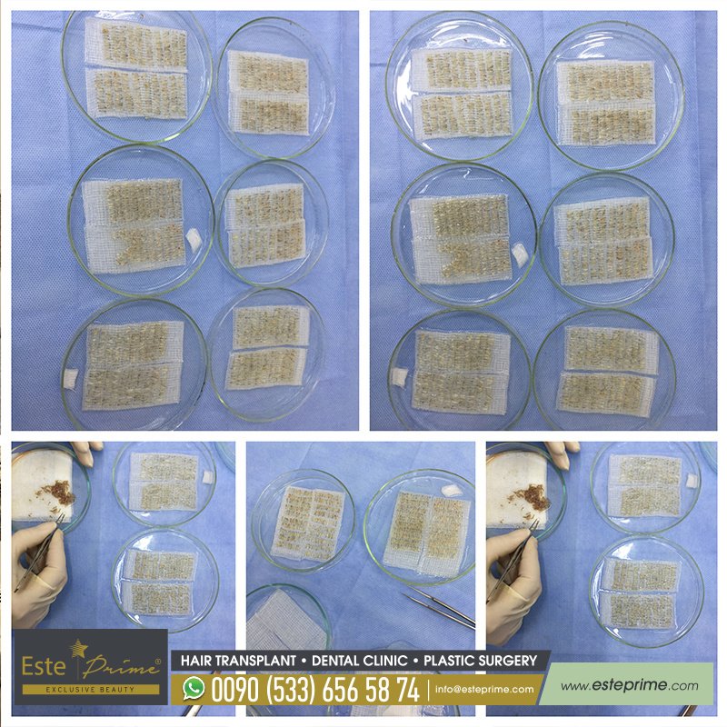 Este Prime - Este Prime