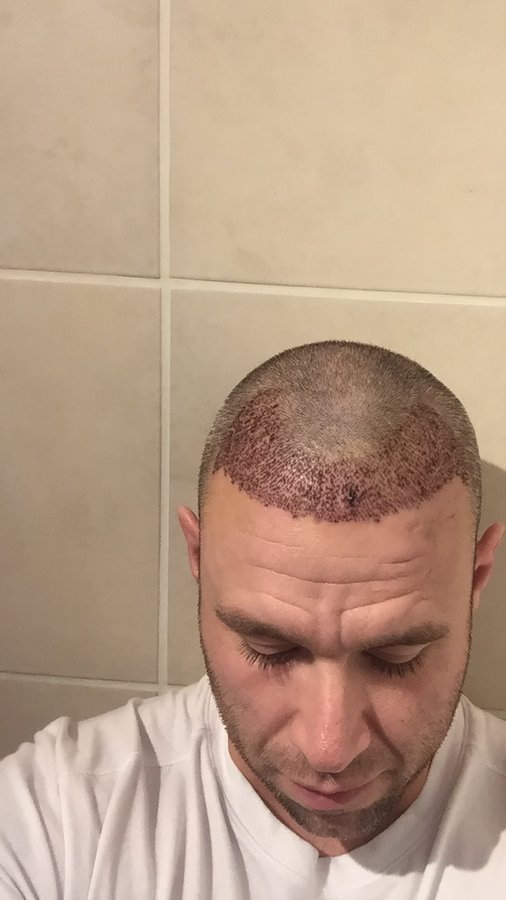 Este Prime - Este Prime