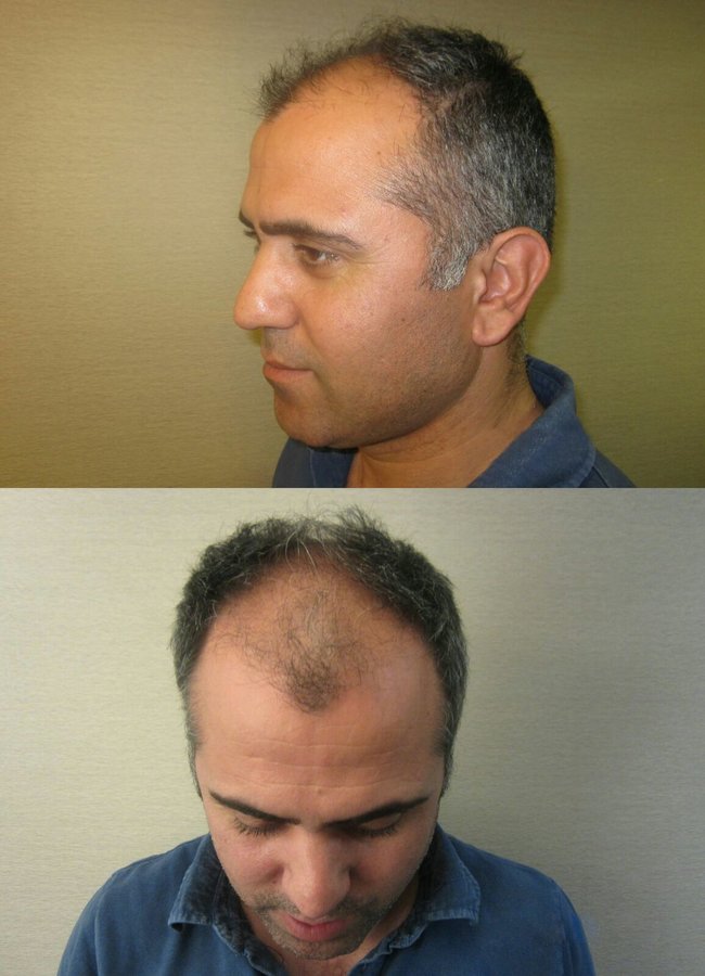 Este Prime - Este Prime