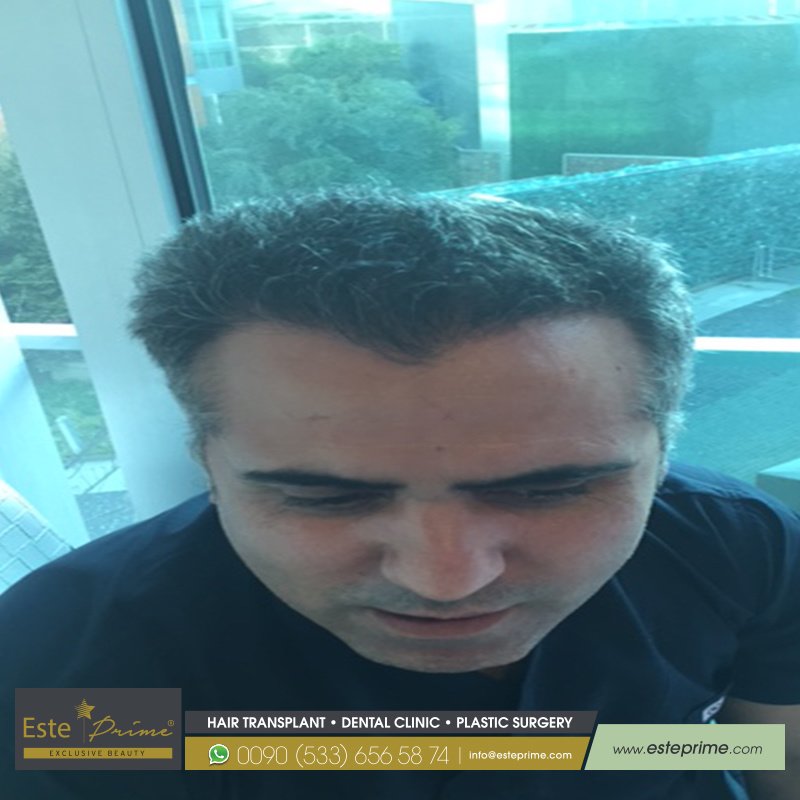 Este Prime - Este Prime