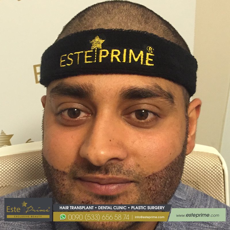 Este Prime - Este Prime