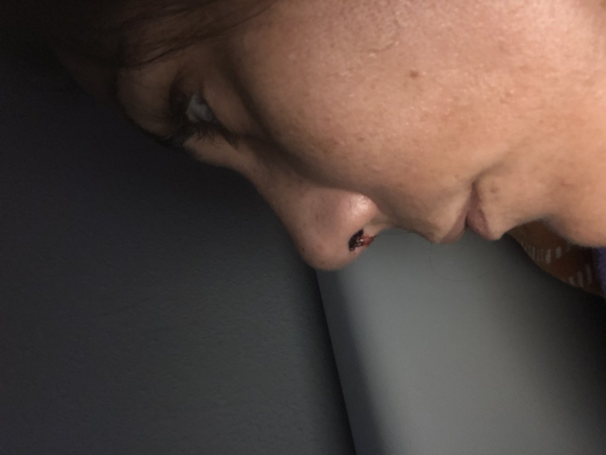 إستيسنتر بلاستيك سيراهي ميركزي - Estecenter Plastik Cerrahi Merkezi