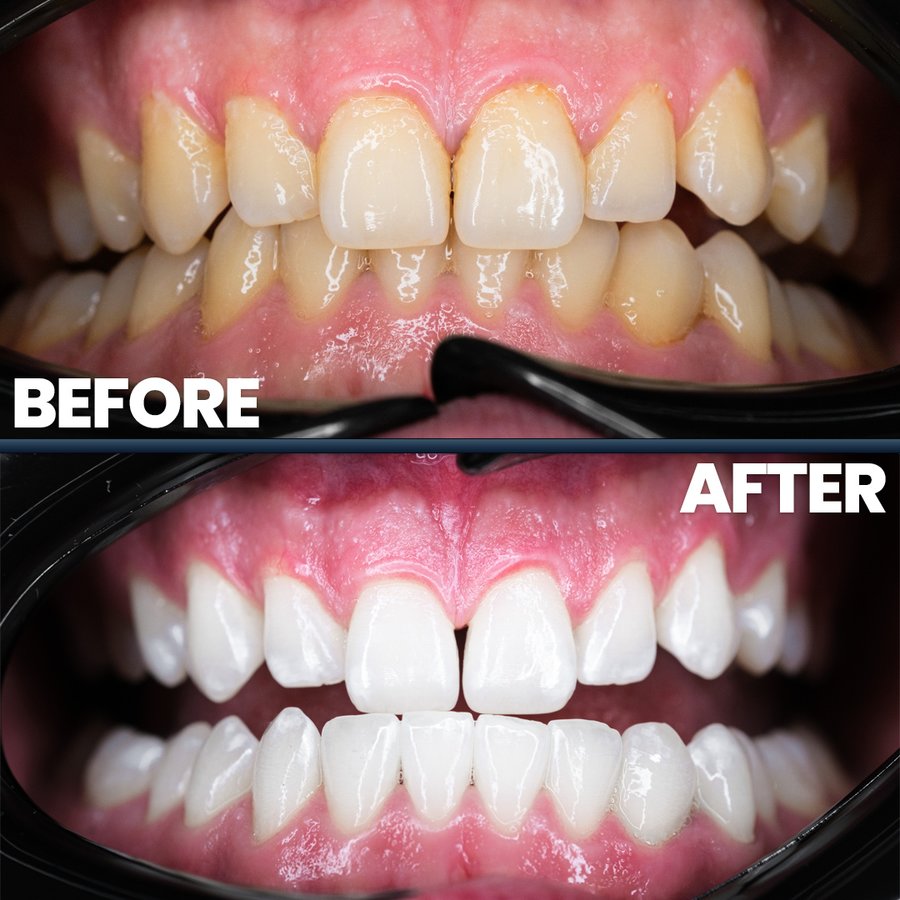 Estedian Dental - Antalya - Estedian Dental - Antalya