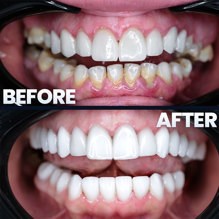 Estedian Dental - Antalya - Estedian Dental - Antalya