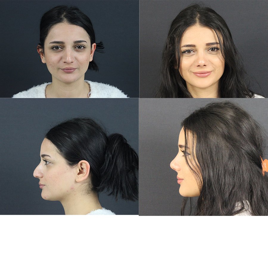 إستيزميت - Esteizmit