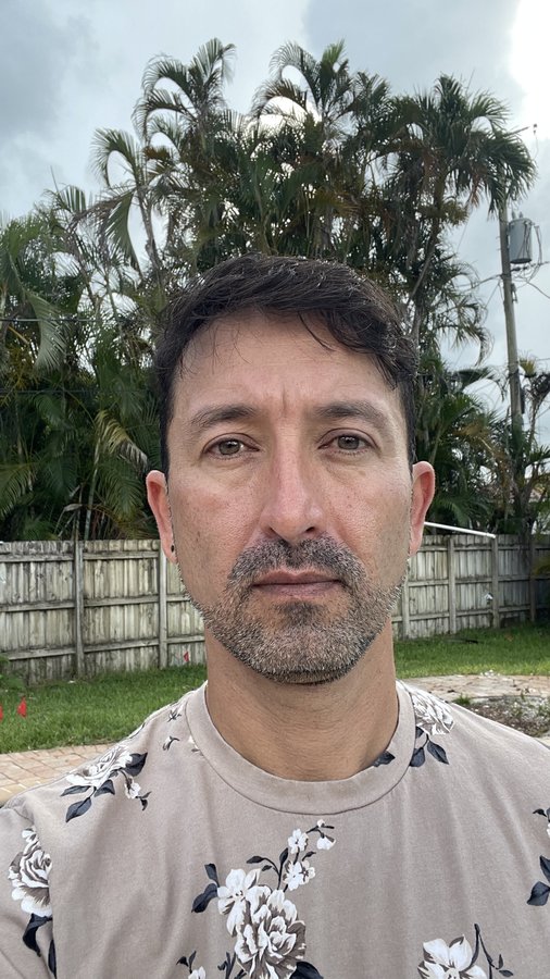 EsteNove Hair Transplant Clinic Turkey - EsteNove Hair Transplant Clinic Turkey