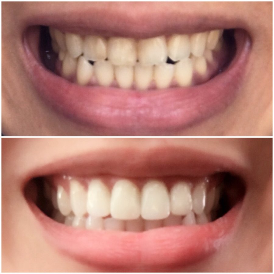 Estetico Manila Dental Clinic - Estetico Manila Dental Clinic